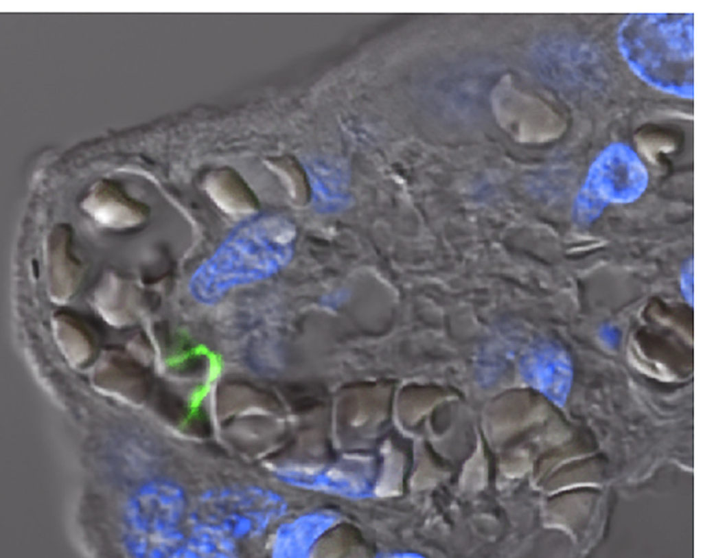 A teljes terhességi folyamat során igazolt Lyme-fertőzés